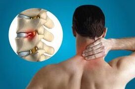 Click the vertebrae