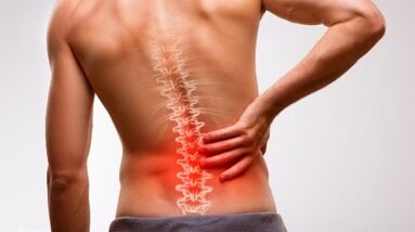 Signs and symptoms of an osteochondrosis of the lumbar spine