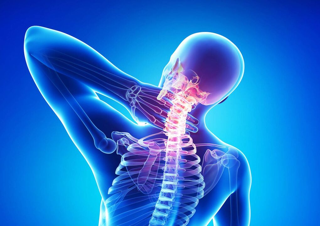Osteochondrosis of the neck