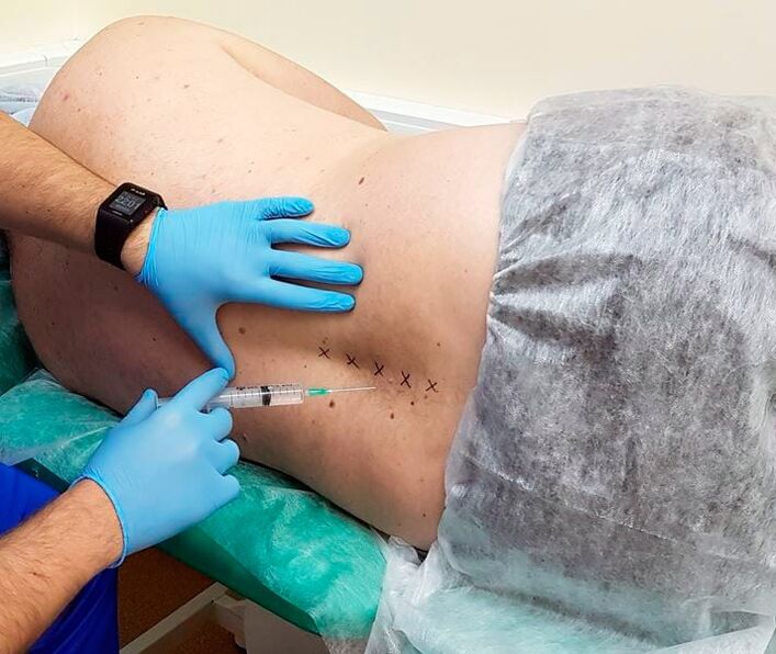 Medical blockages for the back